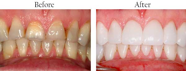 dental images 85209