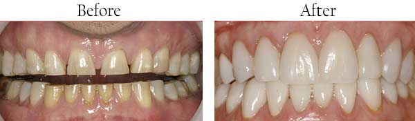 Chandler dental images